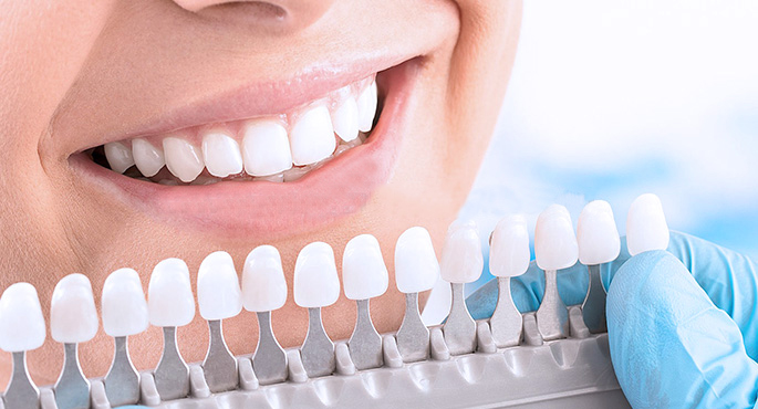 Diş Beyazlatma Kalıcı Mıdır?
