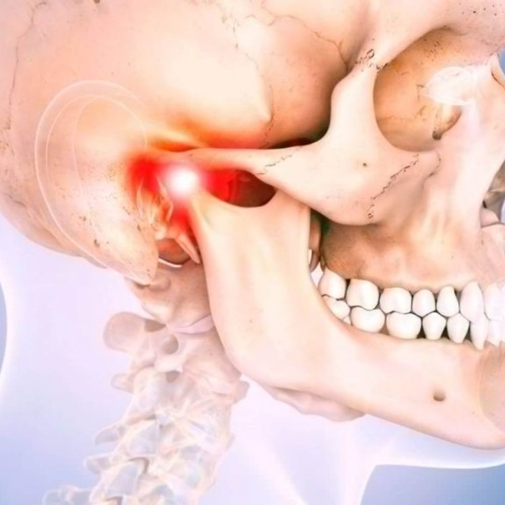 Temporomandibular Eklem Rahatsızlıkları ve Diş Sıkma