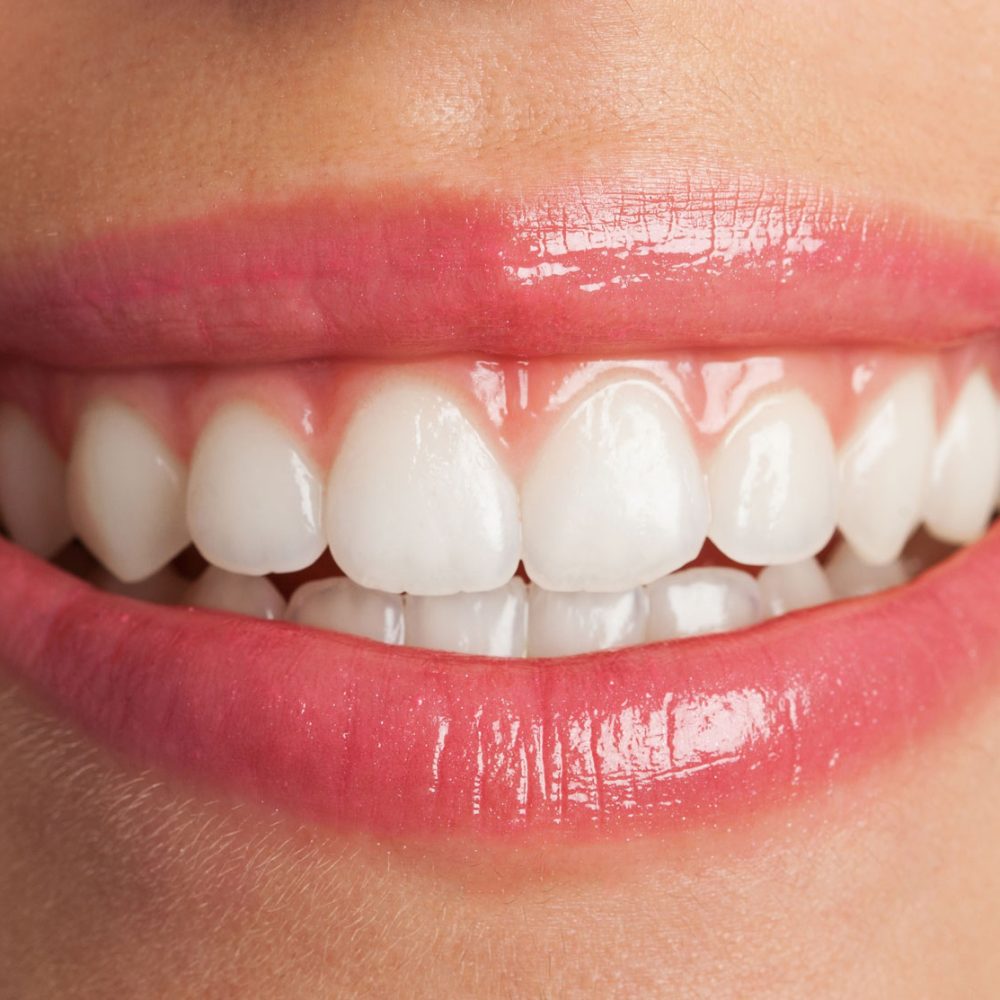 after-teeth