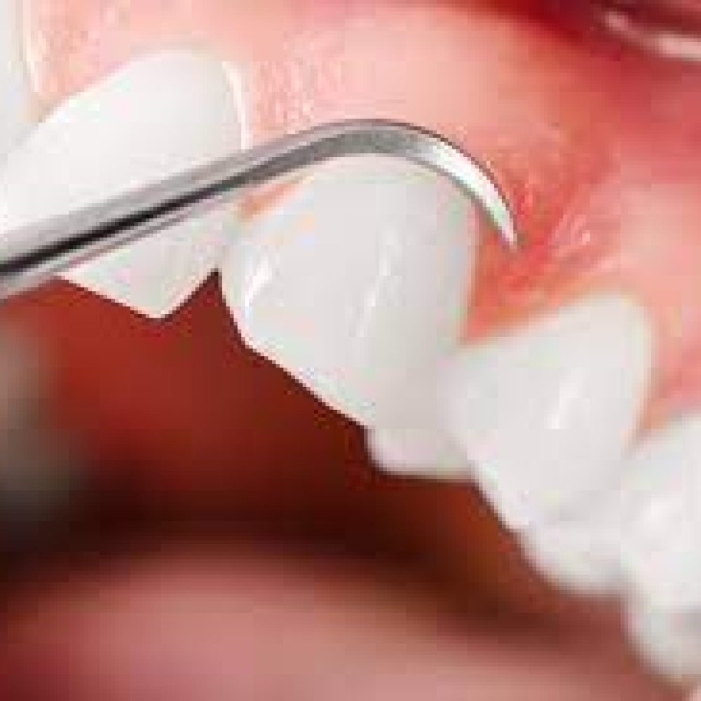 periodontoloji -Deniz Boybeyi